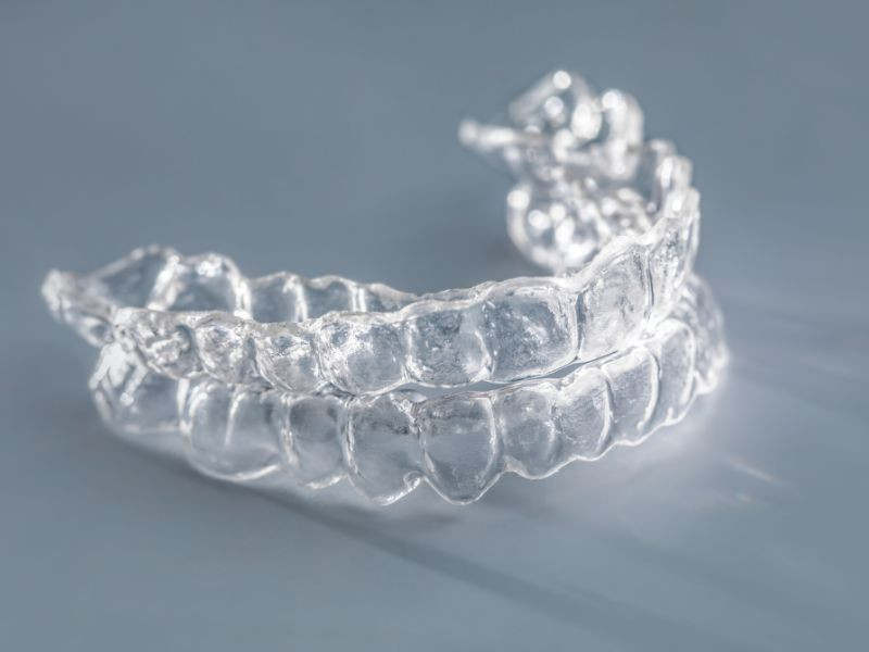 Alinhadores Transparentes: Como Conseguir um Sorriso Perfeito de Forma Discreta?