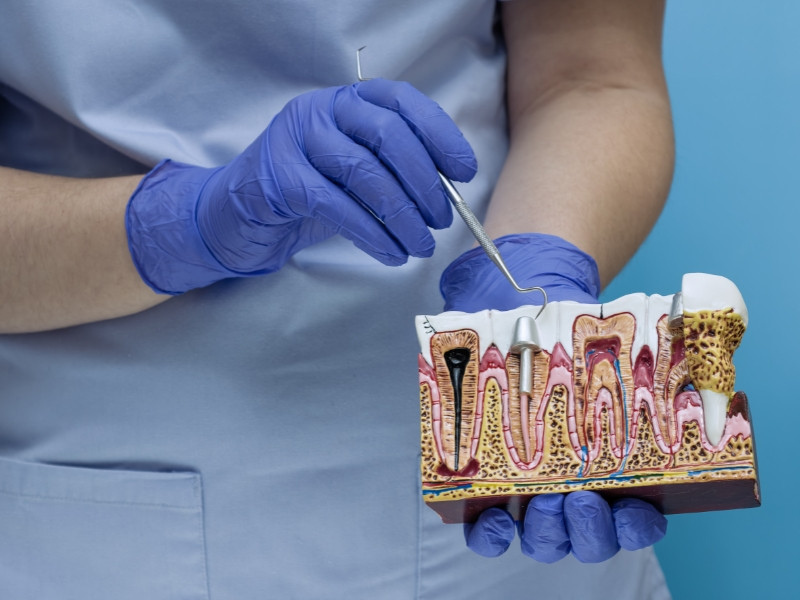 Tratamento Periodontologia