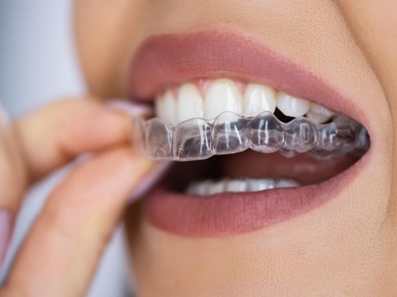 SureSmile
