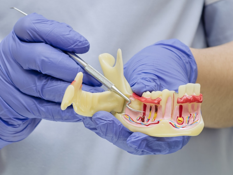 Periodontologia