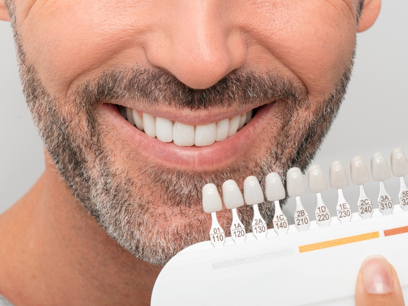 Branqueamento Dentário