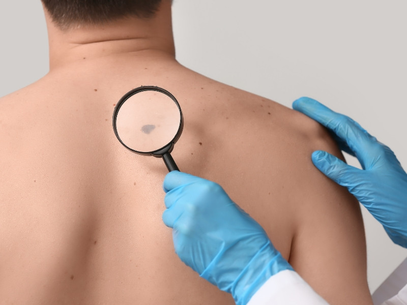 Dermatologista